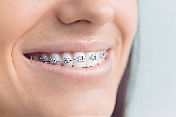 Best Dental Bonding  in Kiefer, OK